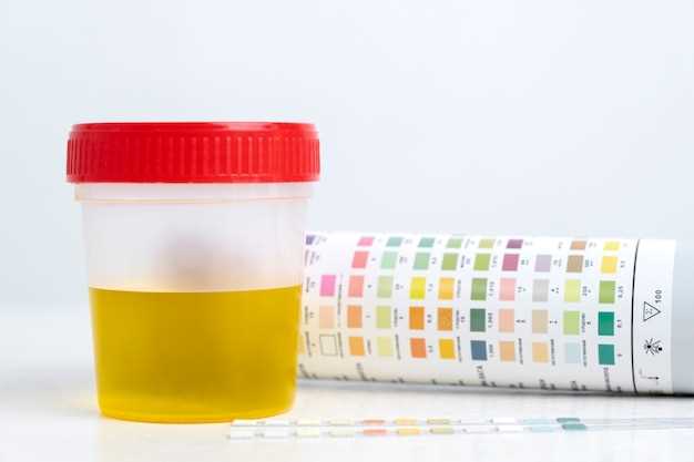 Does mirtazapine show up on a urine test